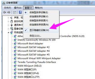 本地连接出现多重网络_本地连接老是获取网络地址_本地网络存在异常怎么办