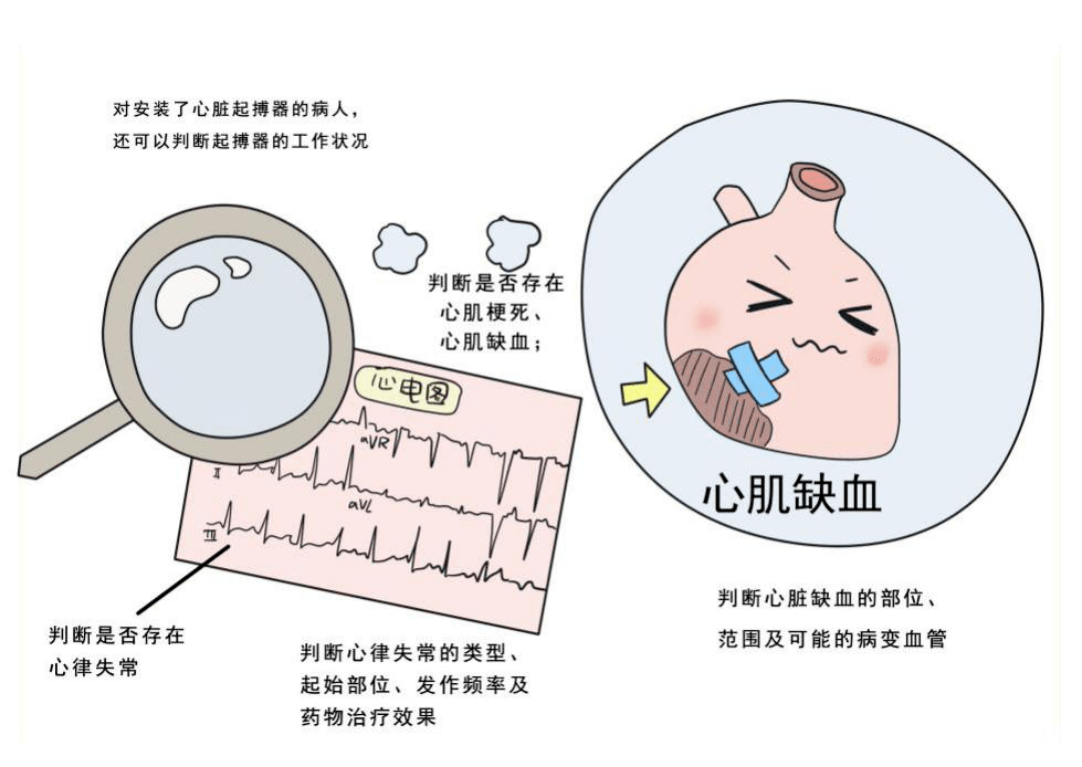 动态脑电图的注意事项_做动态脑电图注意事项_做动态脑电时注意什么