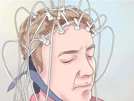 动态脑电图的注意事项_做动态脑电图的图片_做动态脑电图注意事项