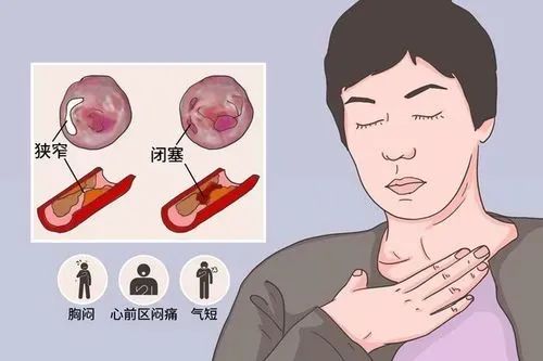 做动态脑电图需要准备什么_做动态脑电图对人体有伤害吗_做动态脑电图注意事项